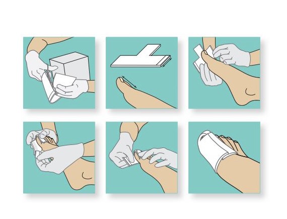 Ligasano бяла стерилна превръзка 14 x 10 x 0,5 cm 1 бр.